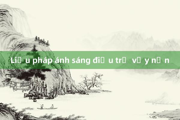 Liệu pháp ánh sáng điều trị vảy nến